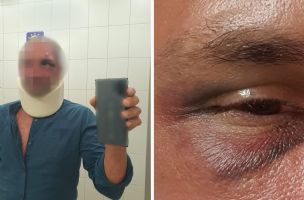 Beograđanin pretučen na Korčuli, napala ga četvorica muškaraca