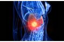 Rak jetre izazivaju hemikalije iz okruženja koje narušavaju funkciju organa - eKlinika