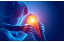 Zašto se javlja bol u kolenu i kako sprečiti komplikacije - eKlinika