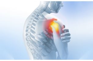Bol u ramenu se može smanjiti i otkloniti uz ove 4 lagane vežbe - eKlinika