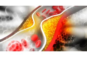 Stomačne bakterije razlažu holesterol