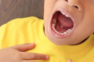 ZUBAR OTKRIVA DA NISTE LOŠ RODITELJ AKO DETE IMA KARIJES: Kada pocrni zub, ne znači uvek da ste vi pogrešili